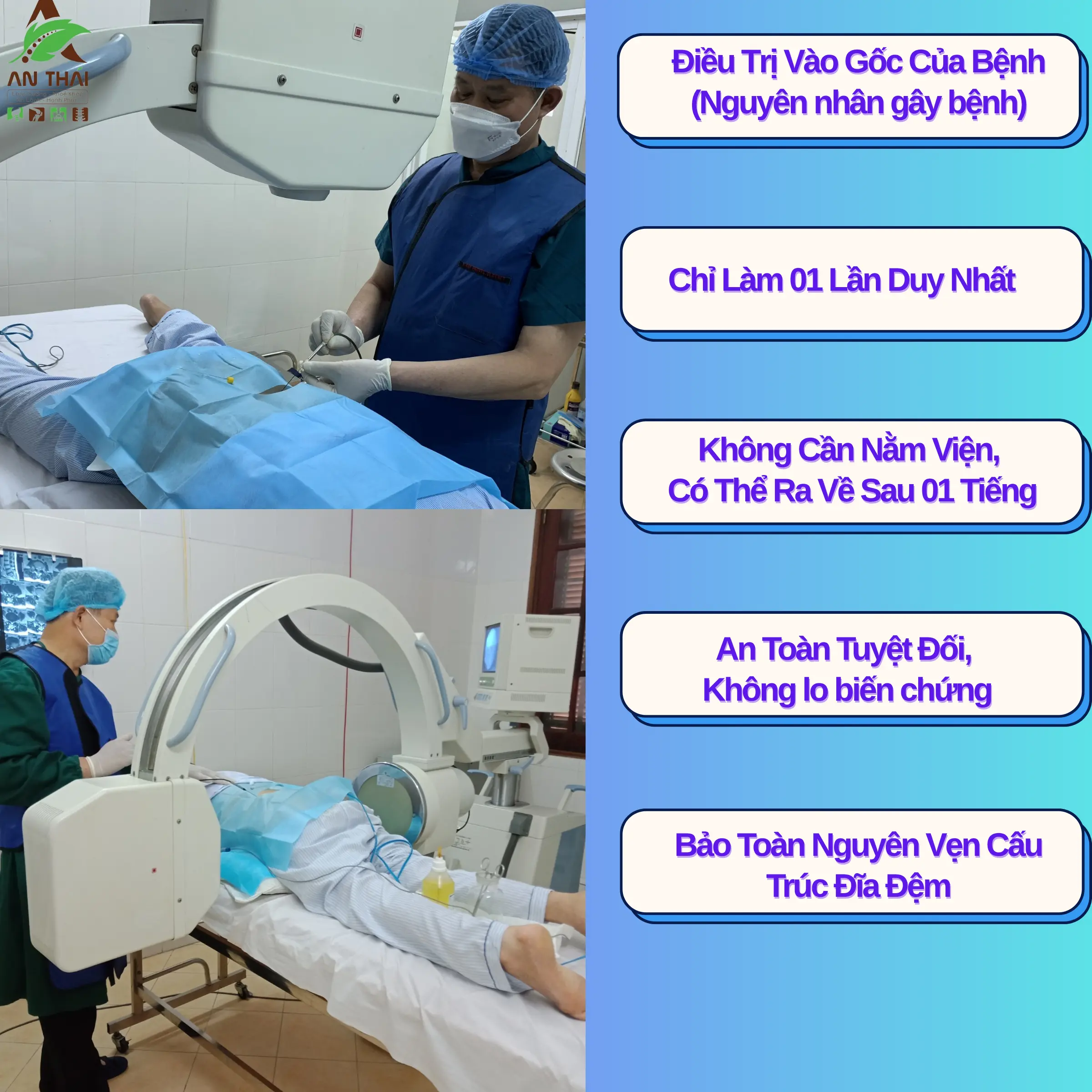 Ưu điểm của RFA