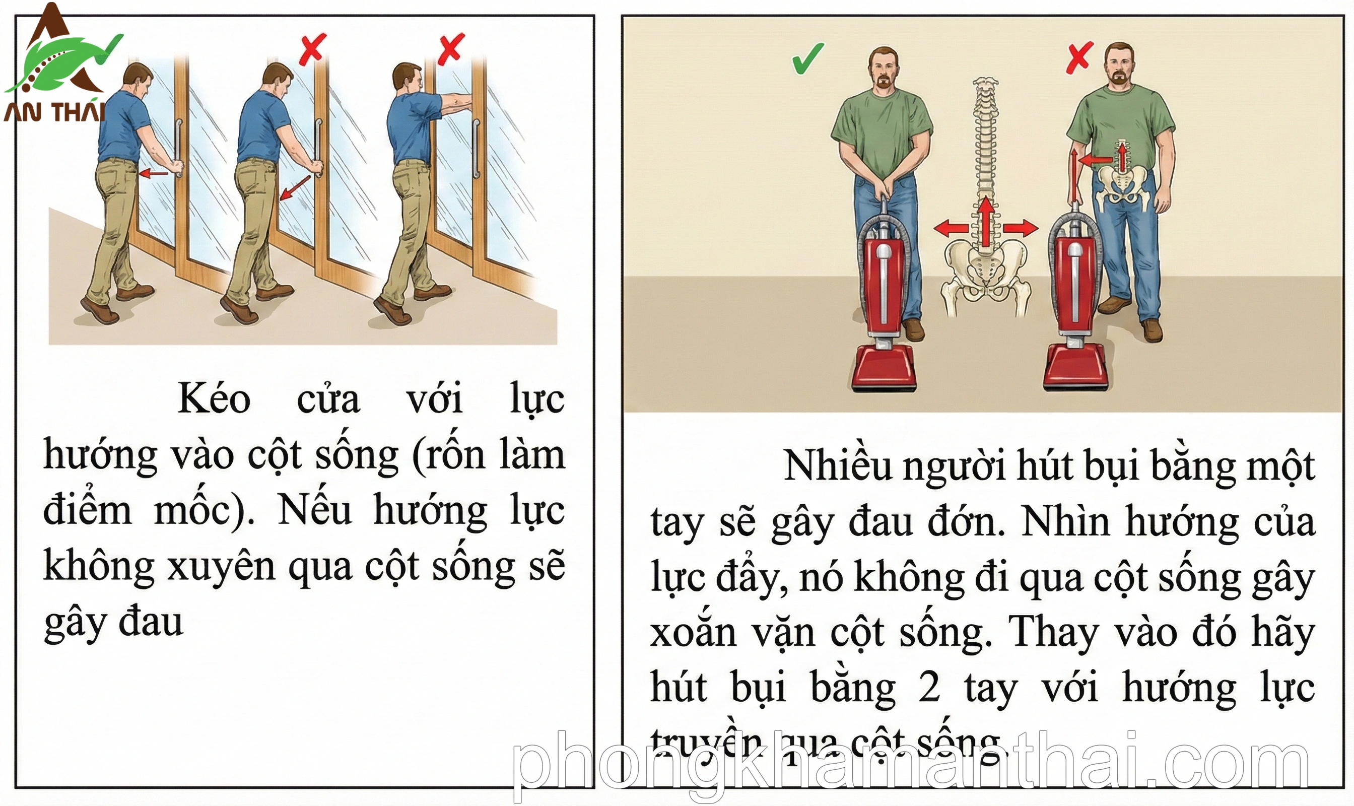 Kỹ thuật đẩy và kéo