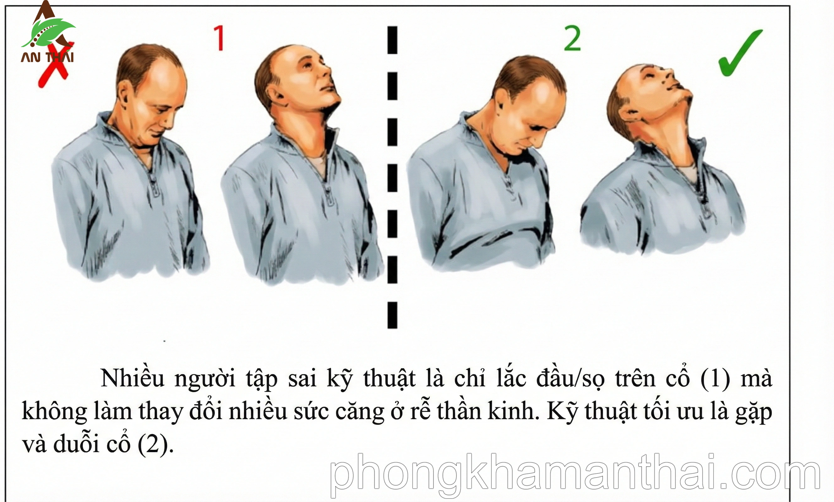 Kỹ thuật trượt thần kinh 2